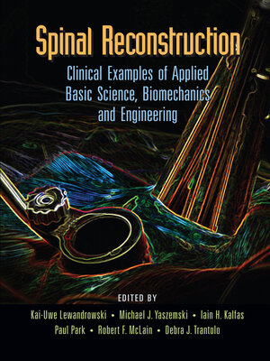 cover image of Spinal Reconstruction